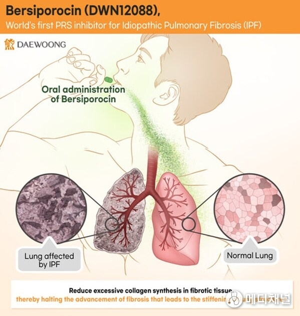 Daewoong Pharmaceutical Third IDMC Reaffirms Safety of Bersiporocin and Recommends Continuation of Global Phase 2 Clinical Trial